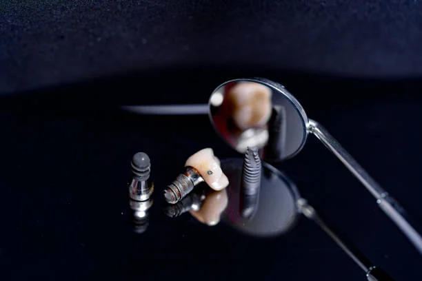 Types of Dental Implants - Learn About Your Options for Tooth Replacement